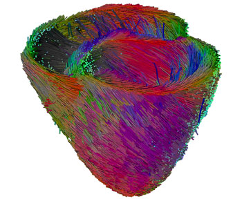 Figure 2: Fibre tracking performed on an average canine heart built from nine images.
