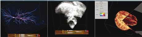 Figure 2: Some examples of interaction and visualization in the PSS. From left: 3D and 4D microscopy; Cardiology, 3D and 4D Ultrasound; Brain Research, segmented CT data.