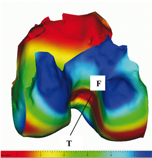 Figure 3: Optimization of the ligament position.