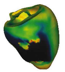 Figure 1: Simulation of the action potential and re-entry on the ventricular section of the heart visualized as geometry.