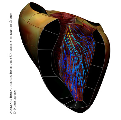 Oxford-Auckland multiscale model of a human heart, representing the anatomy, the muscles fibres orientation and the hemodynamics. Image courtesy of David Nordsletten and Nic Smith, University Computing Laboratory, University of Oxford.