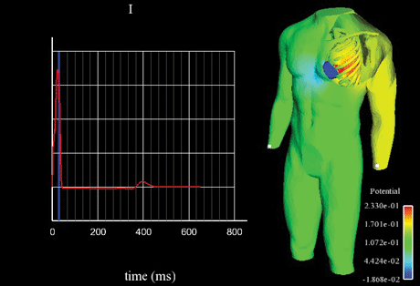 Electrical activity of the heart coupled to the torso: first standard lead of an electrocardiogram. A simulation realised by the INRIA REO team. 