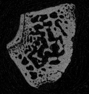 Figure 2: Discrete tomography improves CT scans. The image of this mouse thighbone can be approximated with only two grey levels, making it a perfect application for discrete tomography. Courtesy of Skyscan, Belgium.