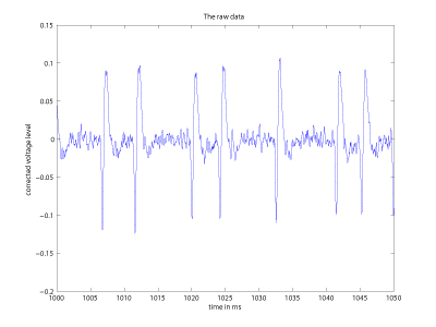 Figure 1: A sample of recorded activity from a dying neuron. Listening to the sonified signal is really spooky, as it strongly resembles a scream.