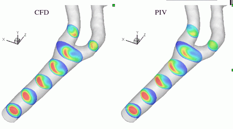 Figure 1: (left) Numerical steady velocity isocontours in selected cross-sections of a carotid artery network; (right) velocity field measured in the same loci using PIV. The phantom was built by rapid prototyping from the surface mesh of the computational model (study carried out at Ecole Polytechnique de Montréal in the framework of INRIA Associated Team 'CFT'). 