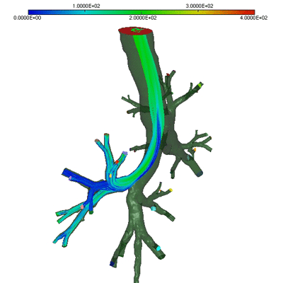 Streamlines at peak expiratory flow in an image-based model of the tracheobronchial tree (surface mesh derived from the French national 'RMOD' project) coupled to lumped parameter models of small bronchi/bronchioles and pulmonary acini (piston-like motion) using an in-house fluid solver. Resistance is higher in a selected lobule (from L. Baffico, C. Grandmont, M. Grasseau and B. Maury).